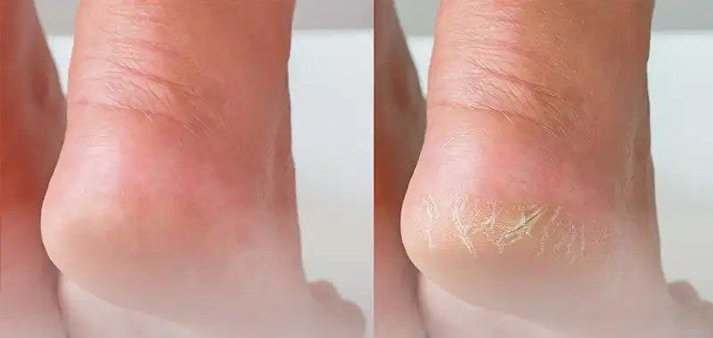 تصویر 1 از خرید پارافین مایع بهداشتی دست و پا + قیمت فروش استثنایی